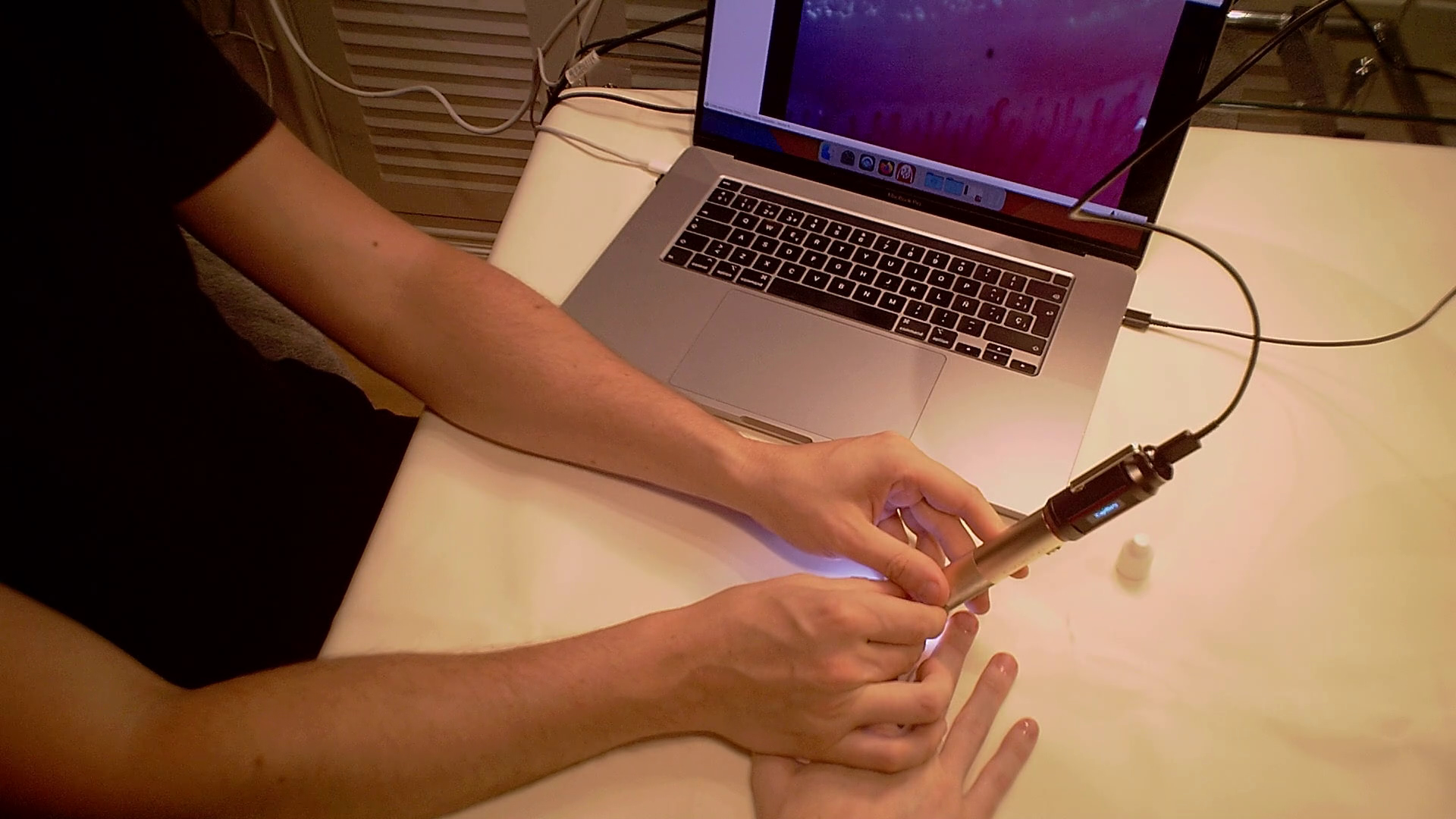 Capillary.io CapillaryScope desktop application being used with Smart G-Scope to perform a capillaroscopy