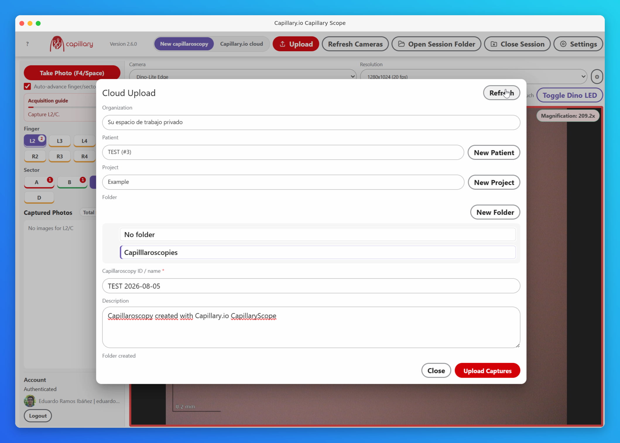 CapillaryScope study upload screen with patient, finger, sector, and device metadata