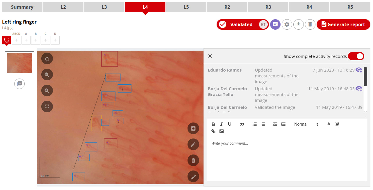 Visualize changes in capillaries made by others (or yourself) interactively with Capillary.io.