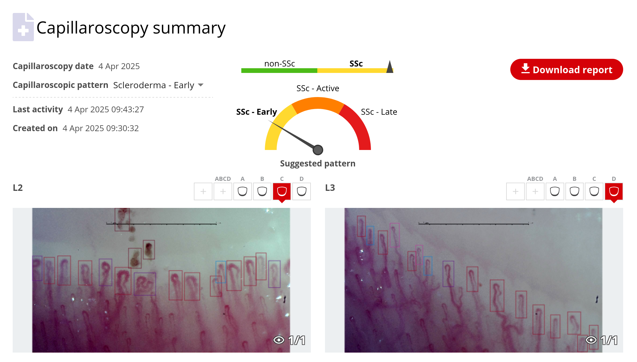 Capillarsoscopy example at Capillary.io web application