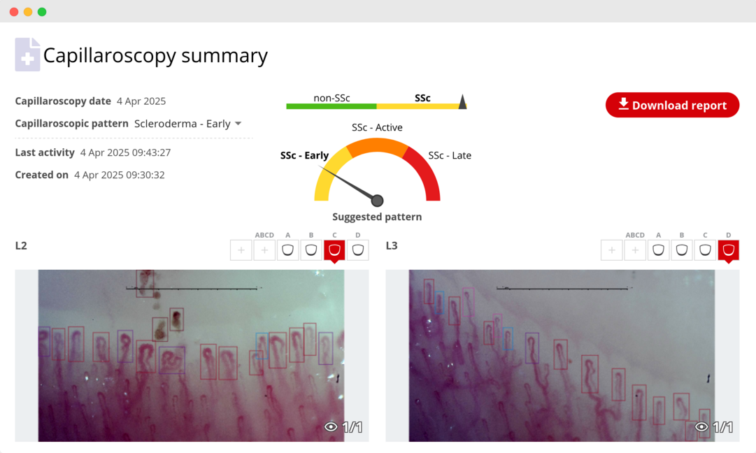 Capillaroscopy software screenshot