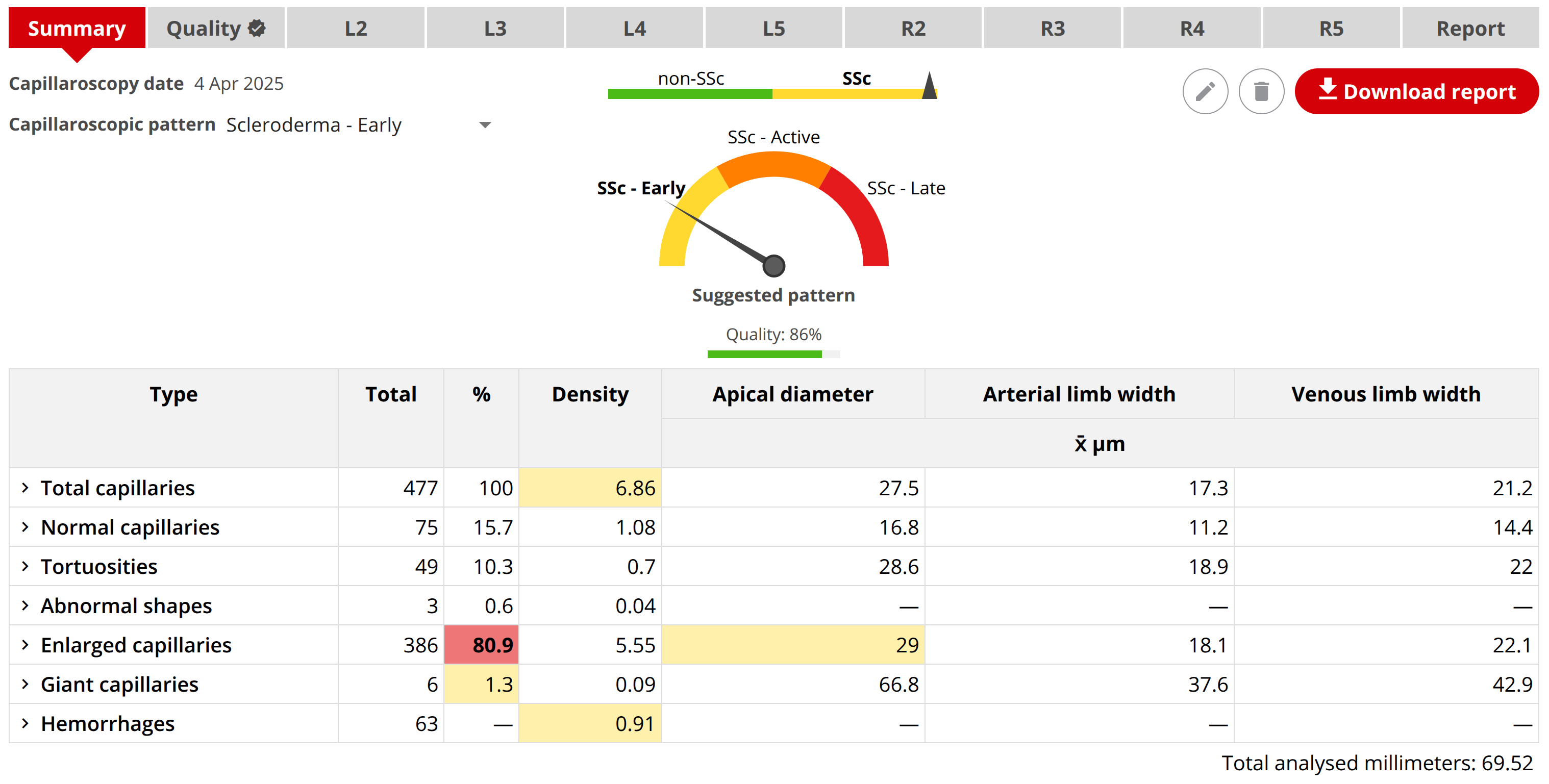 An improved platform for capillaroscopy An improved platform for capillaroscopy
